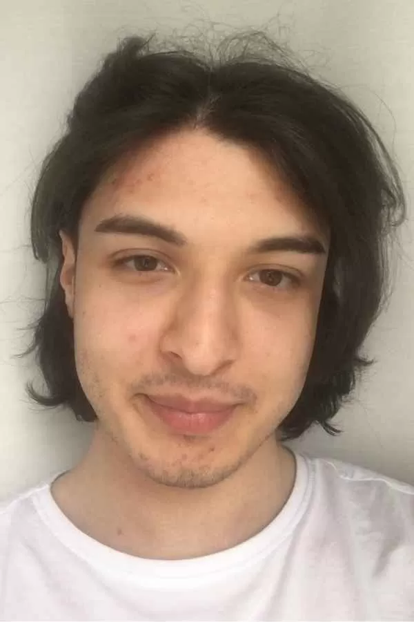 Enes Yılmaz, fotoğraf 7