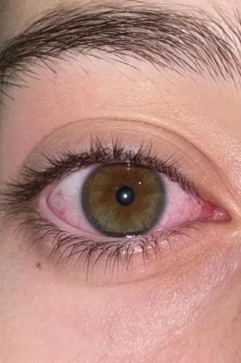 Cast Ajans Yapım Rabia A