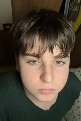 Burak