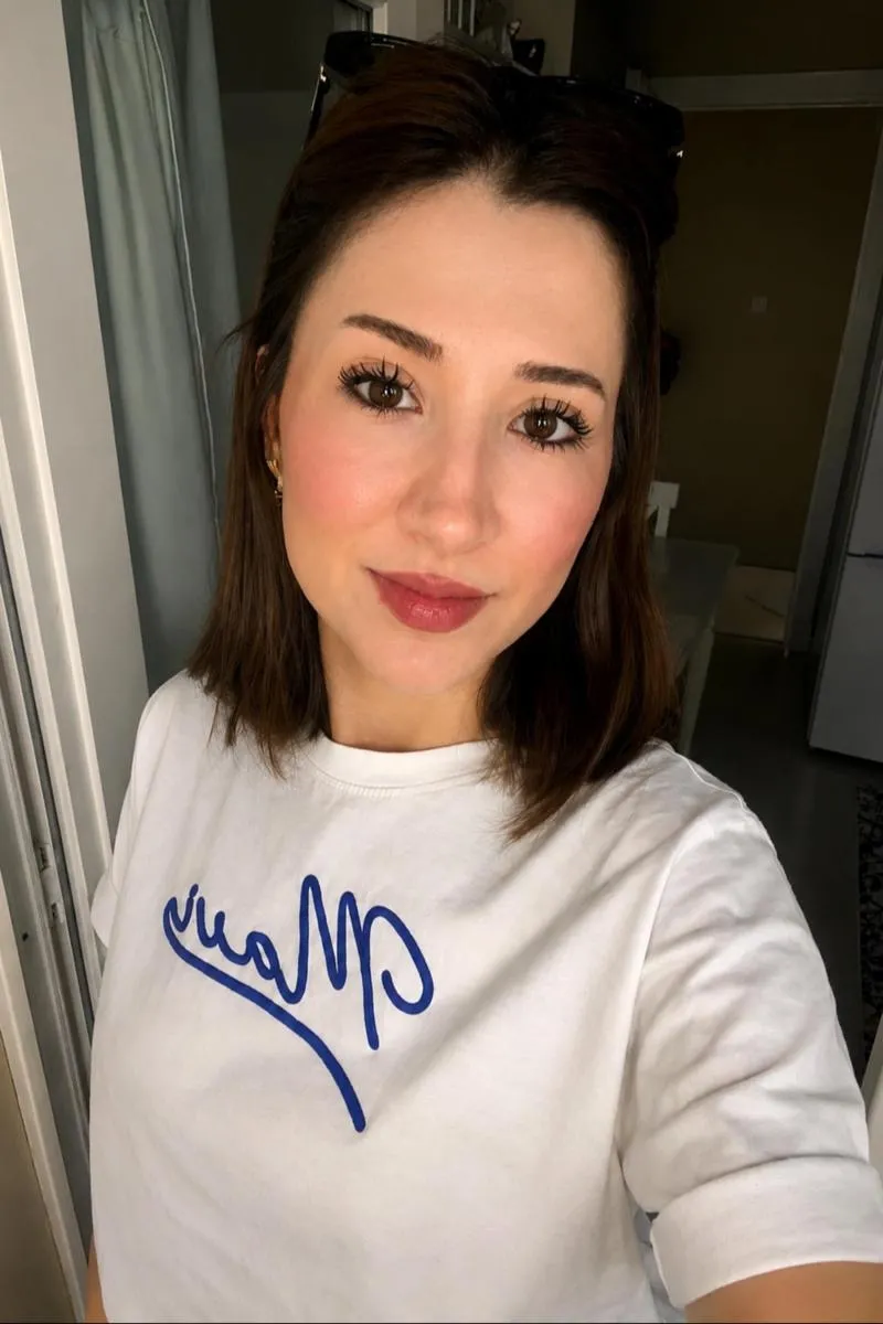 Buse akbaba, fotoğraf 4