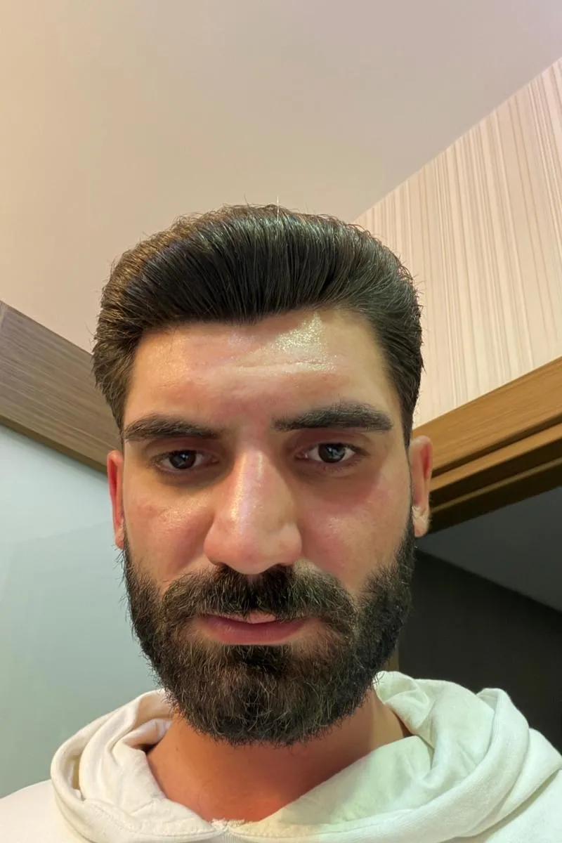Yunus emre özdabakoğlu, fotoğraf 13